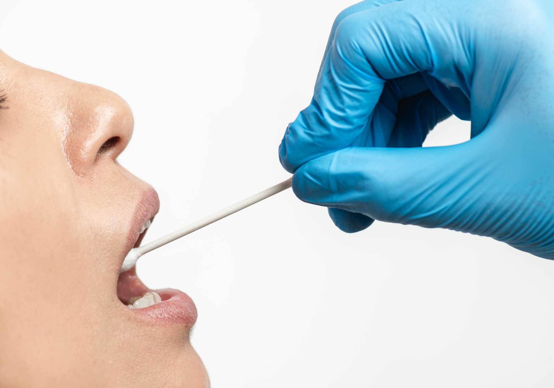 Throat Culture Sampling